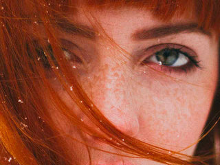 Rougeurs au visage, comment calmer sa peau en hiver