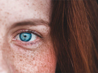 Taches pigmentaires sur le visage : causes et solutions