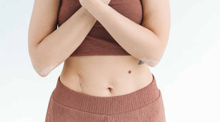 Comment atténuer naturellement ses cicatrices ?