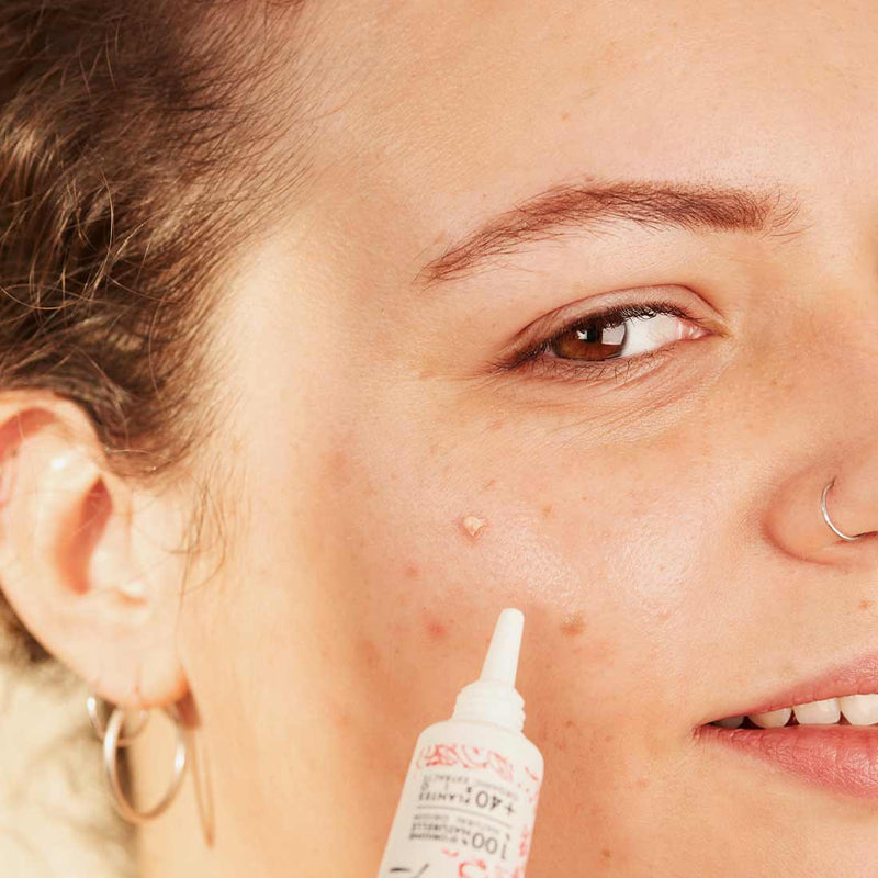 Targeted SOS pimple care