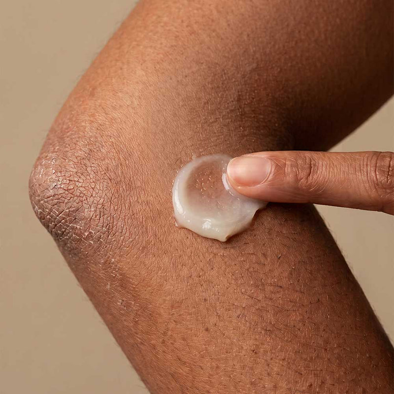 SOS Multi-purpose balm