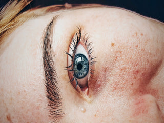 Atténuer les rougeurs sur le visage