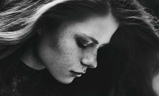 4 conseils efficaces pour éliminer les cicatrices d’acné et les marques de boutons