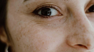 Pourquoi choisir une crème visage anti-taches naturelle ?