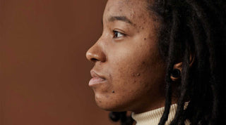 Imperfections visage, comment en venir à bout ?