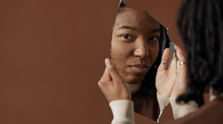 Soigner ses imperfections et faire peau neuve