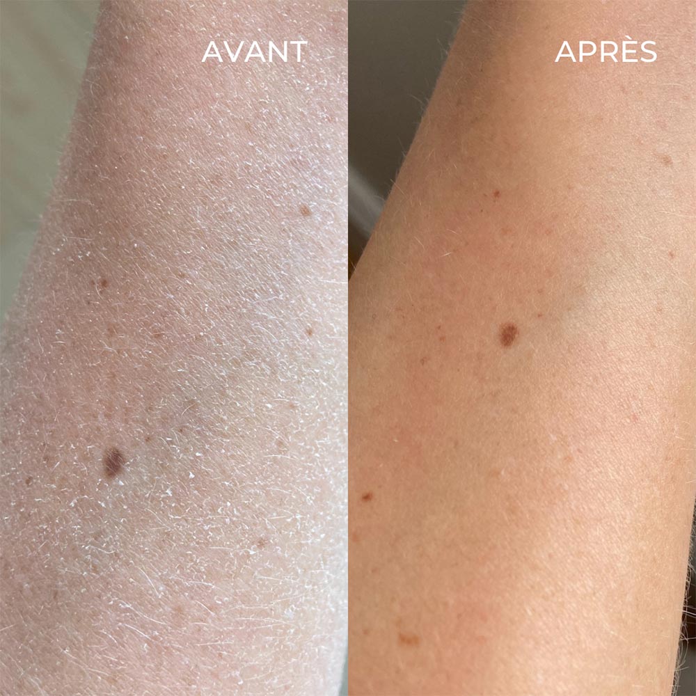 La crème onctueuse relipidante