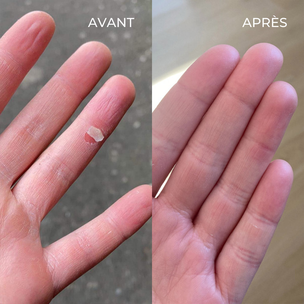 Le baume SOS multi-usages